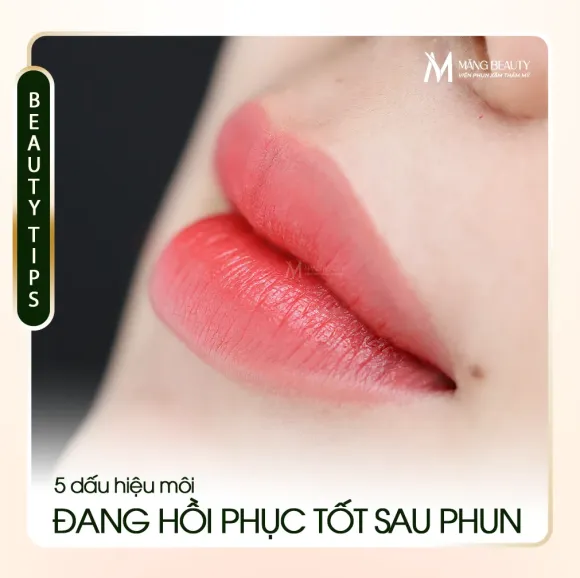 5 Dấu Hiệu Môi Đang Phục Hồi Tốt Sau Phun
