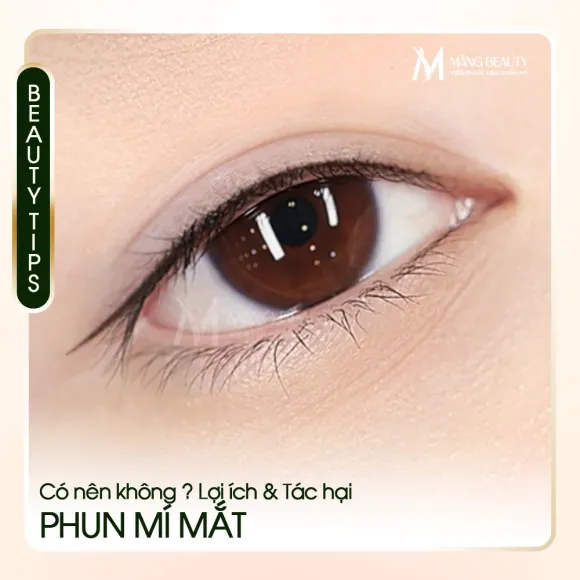 Có nên phun mí mắt không? Lợi ích và tác hại