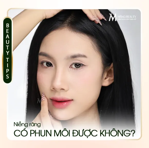 Niềng răng có phun môi được không? Hướng dẫn giúp môi vẫn đẹp tự nhiên dù đang đeo mắc cài