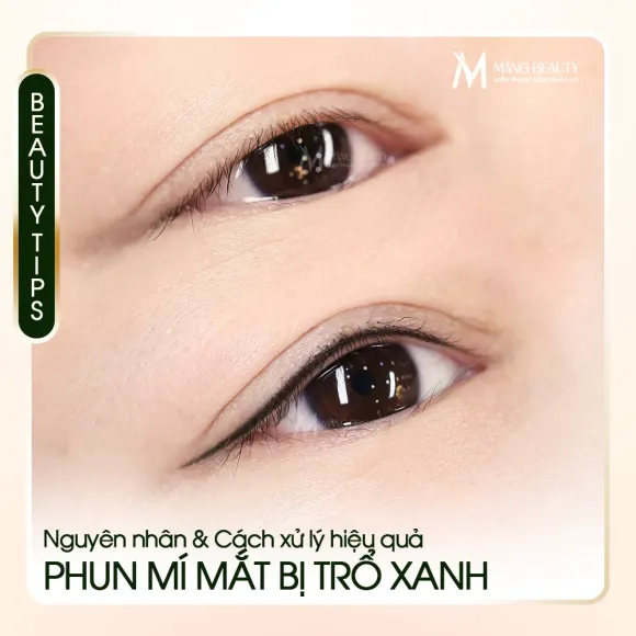 Phun mí có bị trổ xanh không? Nguyên nhân và cách xử lý hiệu quả