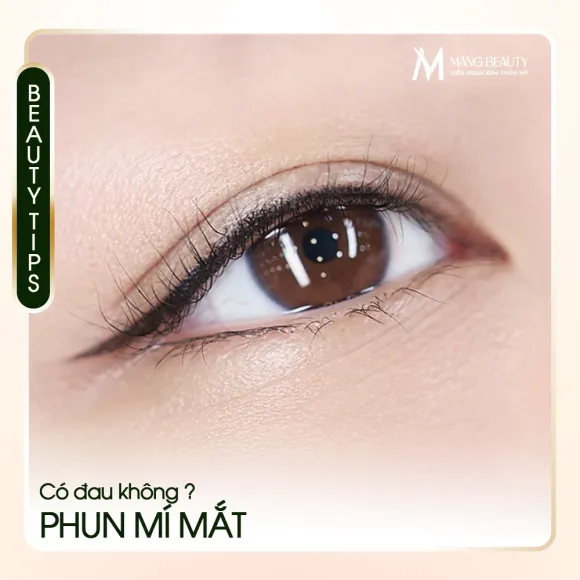 Phun mí mắt có đau không? Mất bao lâu để hồi phục?
