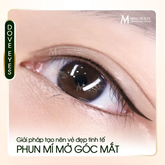 Phun mí mở góc mắt là gì? Giải pháp “mở rộng” vẻ đẹp tinh tế cho đôi mắt tại Măng Beauty