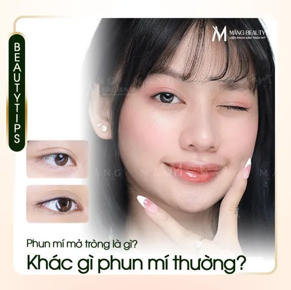 Phun mí mở tròng là gì? Khác gì phun mí thường và có phù hợp với bạn không?