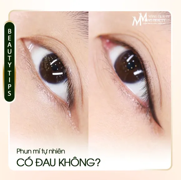 Phun Mí Tự Nhiên Có Đau Không? Hình Ảnh Thực Tế Từ Khách Hàng Măng Beauty