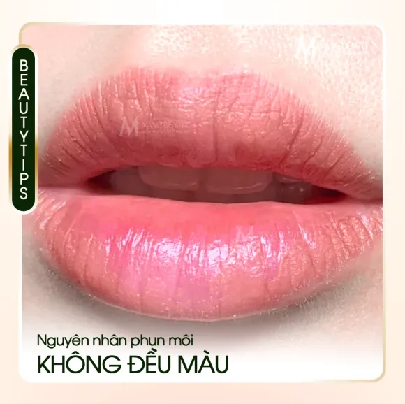 Phun Môi Không Đều Màu Nguyên Nhân Do Đâu? Cách Khắc Phục Hiệu Quả