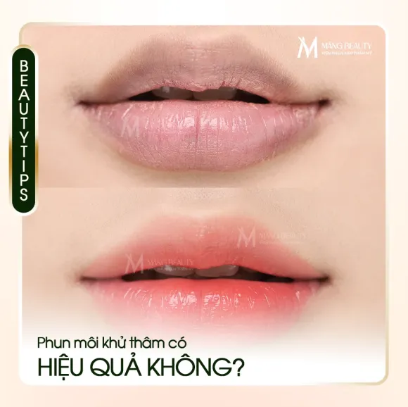 Phun Môi Khử Thâm Là Gì? Có Hiệu Quả Không?