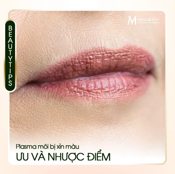 Plasma môi bị xỉn màu có hiệu quả không? Ưu và nhược điểm
