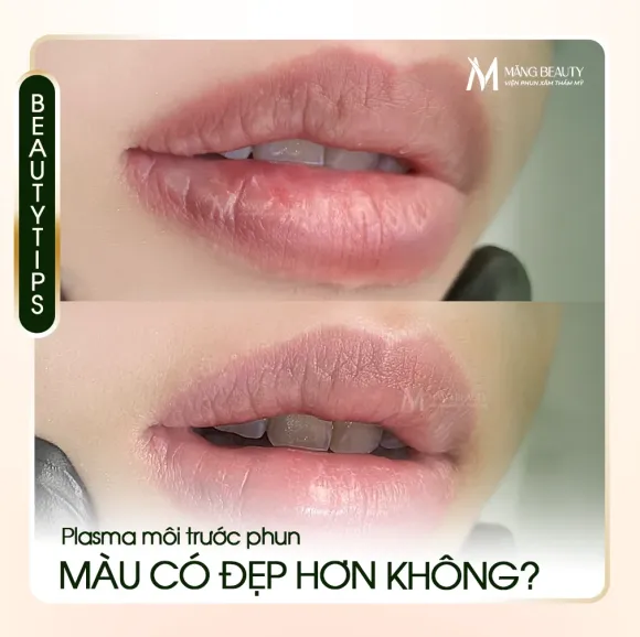 Plasma môi trước khi phun có giúp môi lên màu đẹp hơn không?
