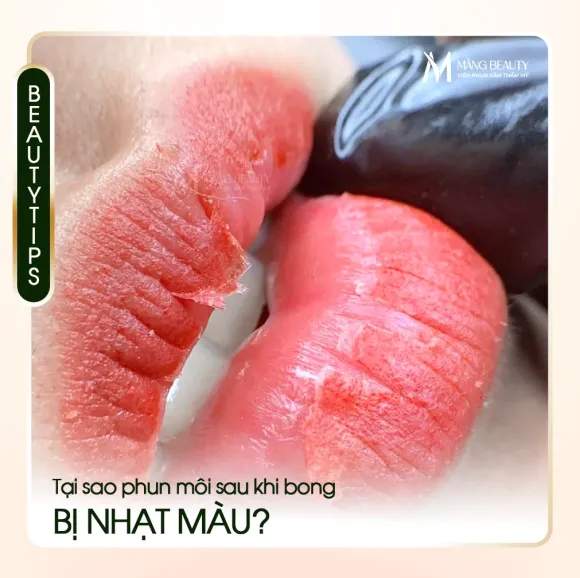 Tại sao phun môi sau khi bong bị nhạt màu? Hiểu về cơ chế ổn định sắc tố