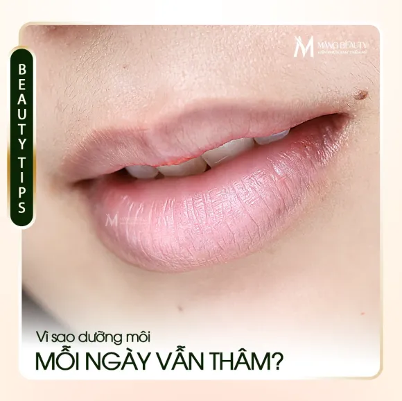 Vì sao dưỡng môi mỗi ngày nhưng môi vẫn thâm?