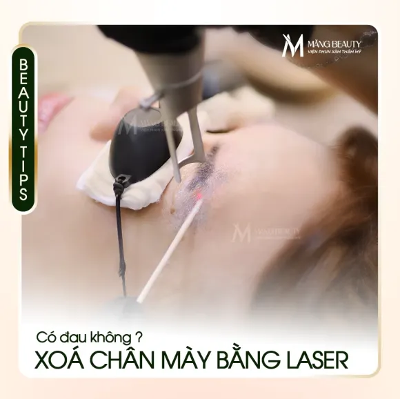 Vì sao nên xoá chân mày bằng laser? Xoá chân mày có đau không?