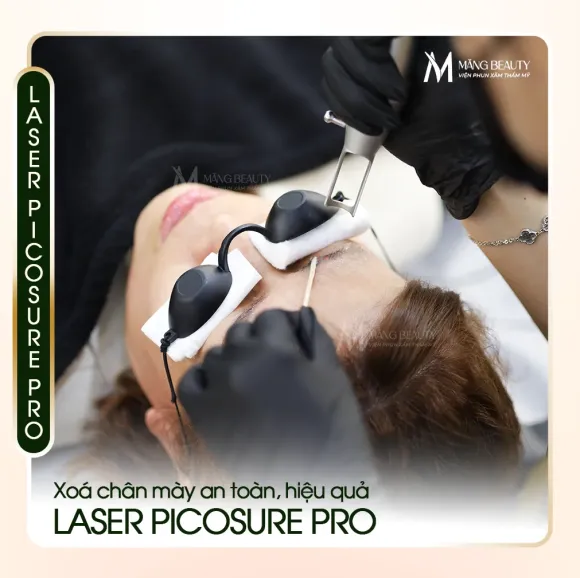 Xóa chân mày bằng Laser PicoSure Pro - Giải pháp an toàn, hiệu quả tại Măng Beauty
