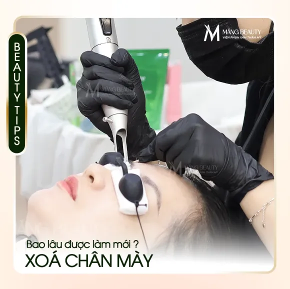 Xóa chân mày xong bao lâu làm lại được? Giải đáp từ chuyên gia Măng Beauty