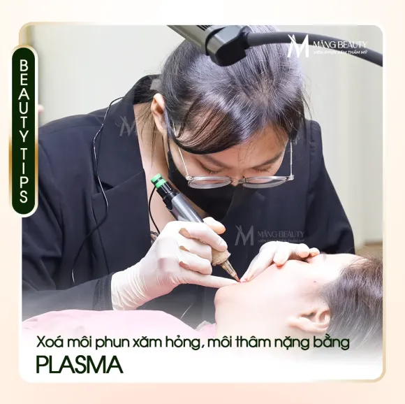 Xóa xăm môi phun hỏng bằng Plasma bao lâu thì bong? Cần kiêng ăn gì?